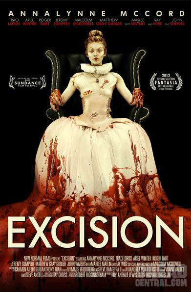 excision.jpeg