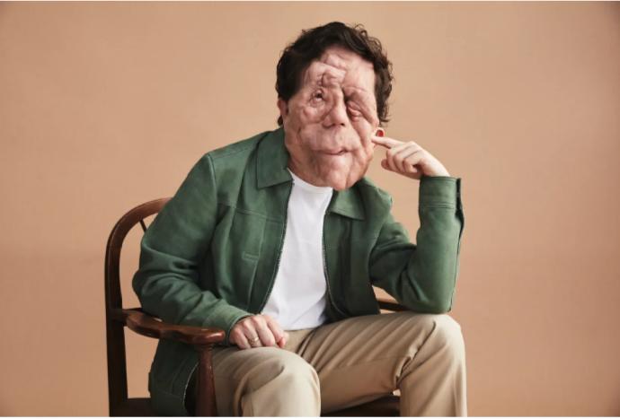 FireShot Capture 1811 - Adam Pearson to Lead New ',The Elephant Man&#039, Film Adaptation - variety.com.png.jpg